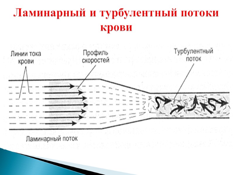 Ламинарный и турбулентный потоки крови